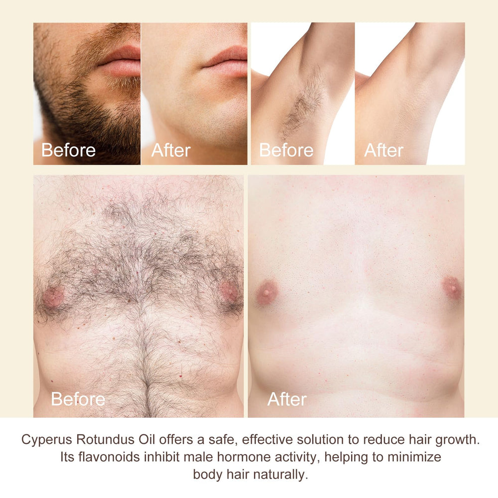 Cyperus Rotundus Oil supports gentle post-removal care.
