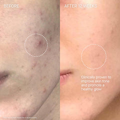 Augustinus Bader The Cream application on face and neck.