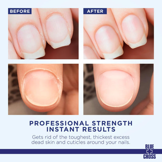 Blue Cross Cuticle Remover Cream applicator top for precise application
