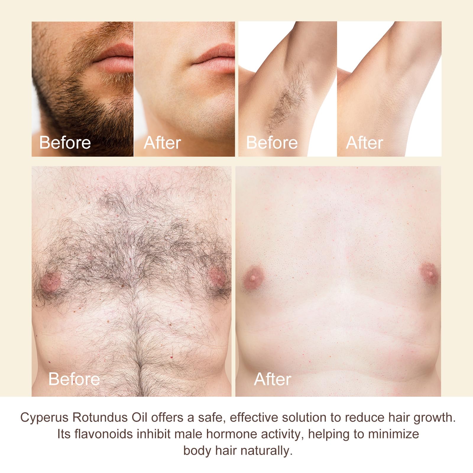 Cyperus Rotundus Oil supports gentle post-removal care.