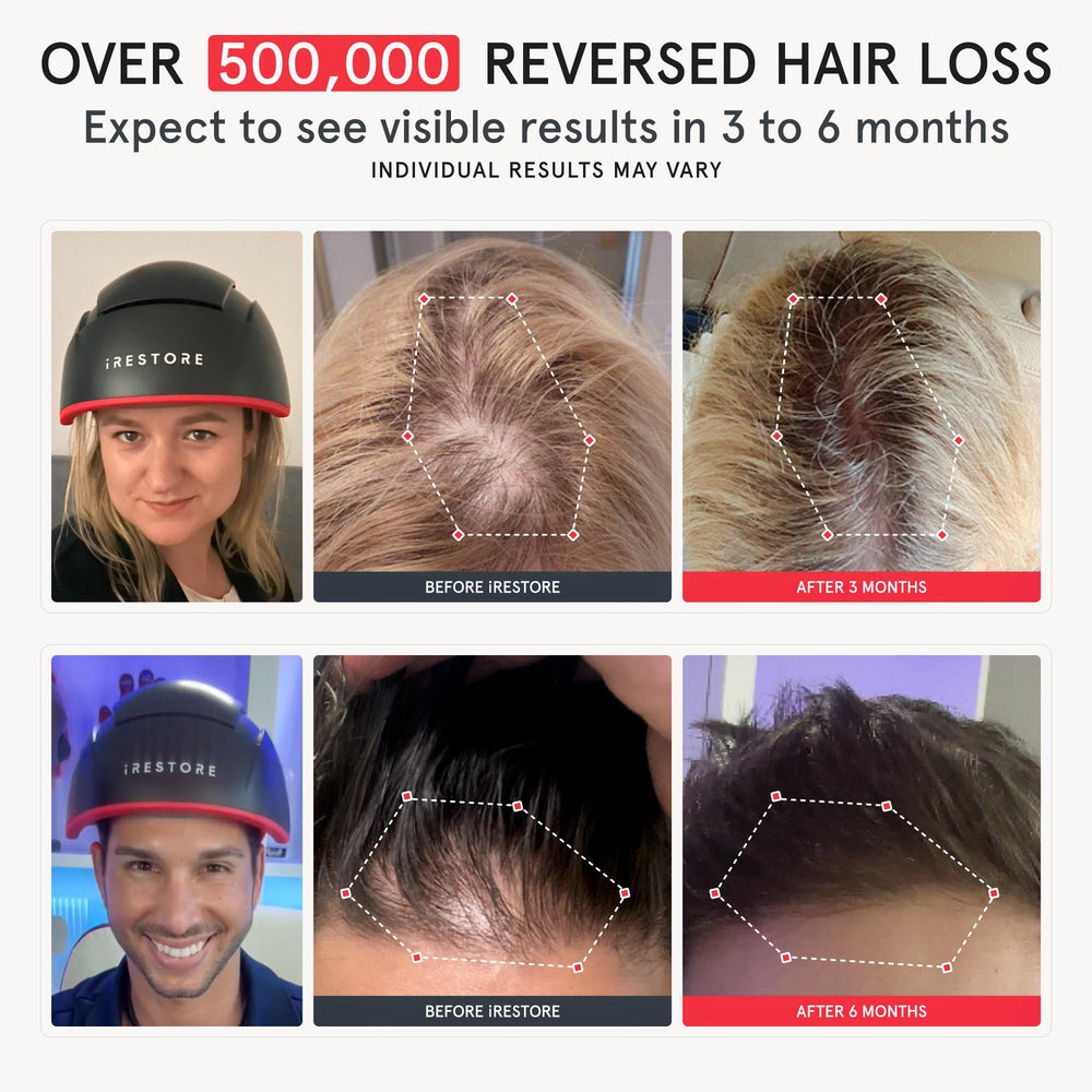 iRestore Elite close-up of laser array targeting thinning areas for deeper follicle stimulation