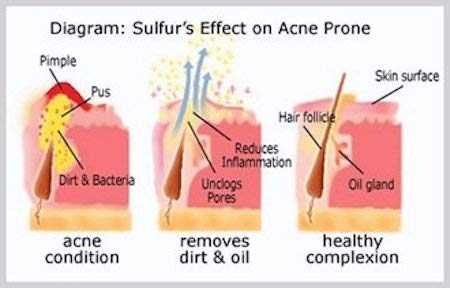 JOESOEF SKIN CARE sulfur soap helps cleanse pores and supports clear skin