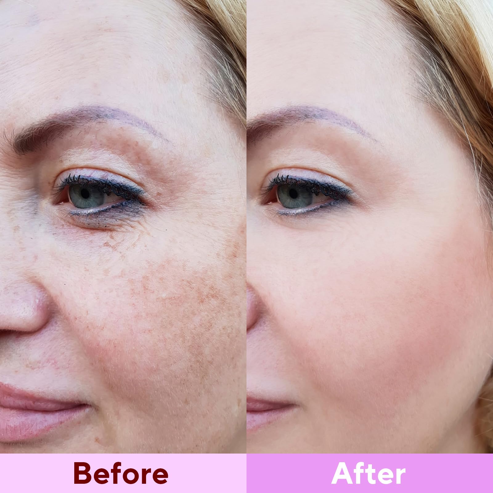 Nityrliv mask after use demonstrates smoother skin texture