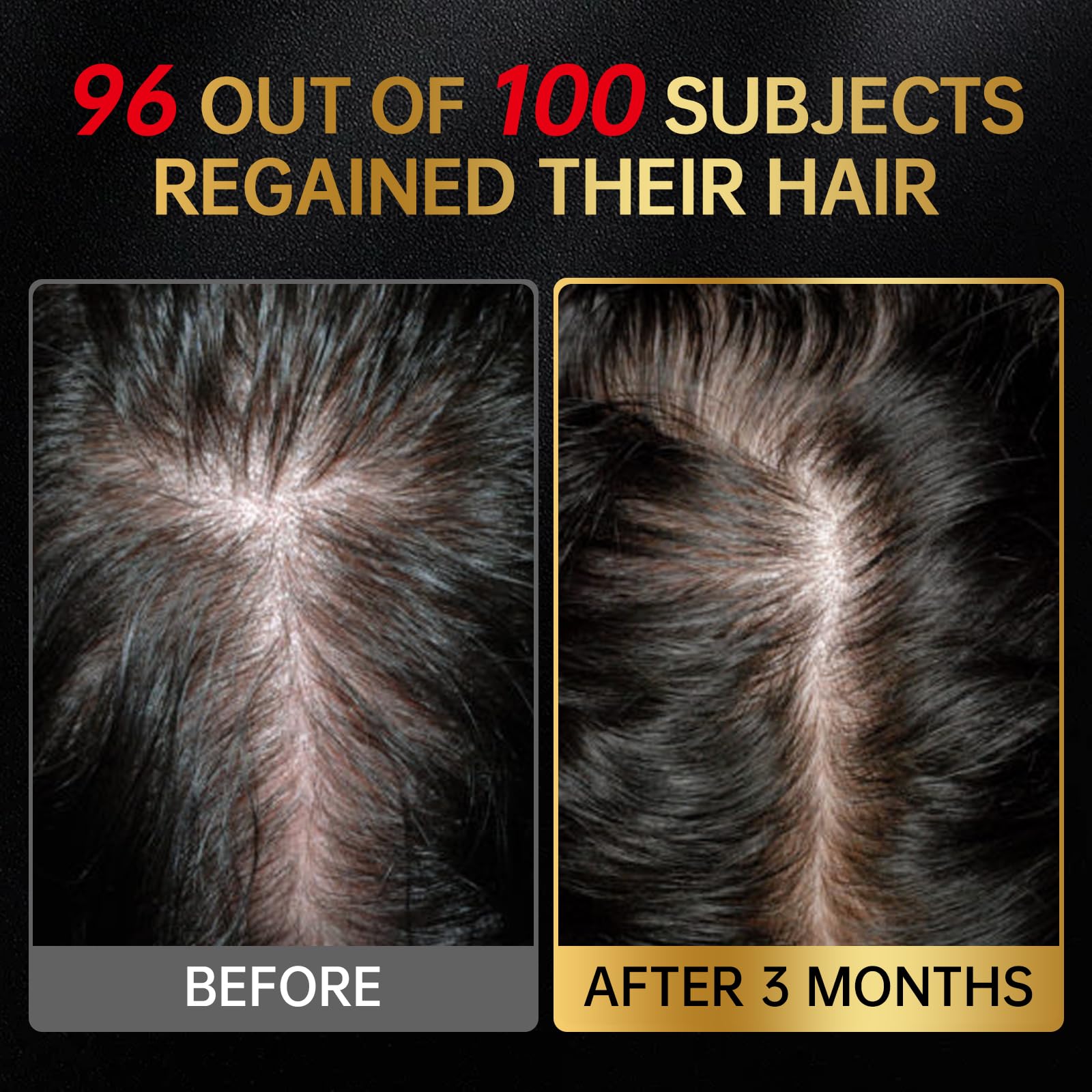 OCSINL minoxidil packaging detail for high-quality labeling.