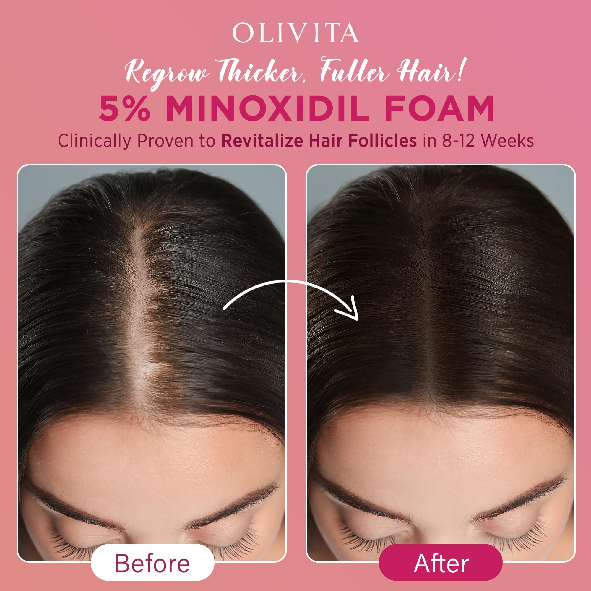 OLIVITA Biotin-Castor-Rosemary-infused formula for nourishing scalp care