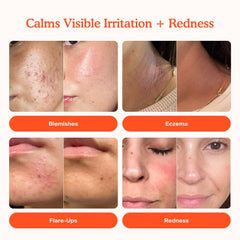 Tower 28 Jumbo SOS Recovery Face Cream spread on skin shows quick soothing hydration.